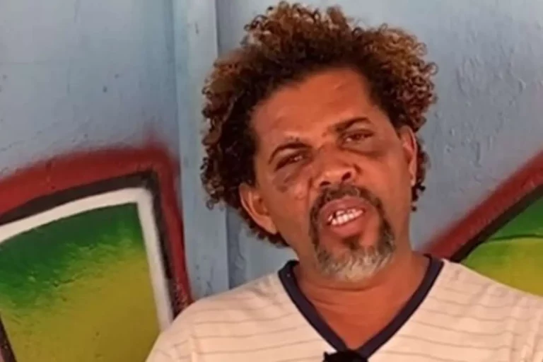 Morador de rua agredido por personal é convidado para ser candidato a deputado