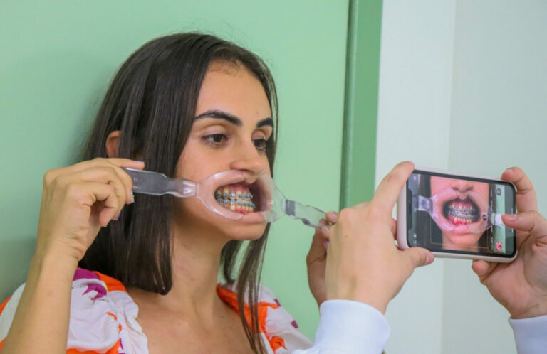 Serviços de cirurgia e traumatologia facial da Fundhacre promovem qualidade de vida