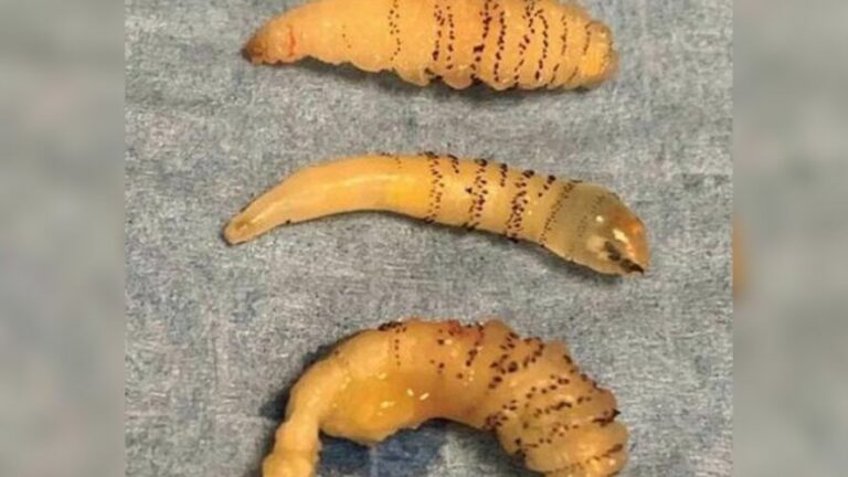 Mulher encontra verme no olho após viagem à Amazônia