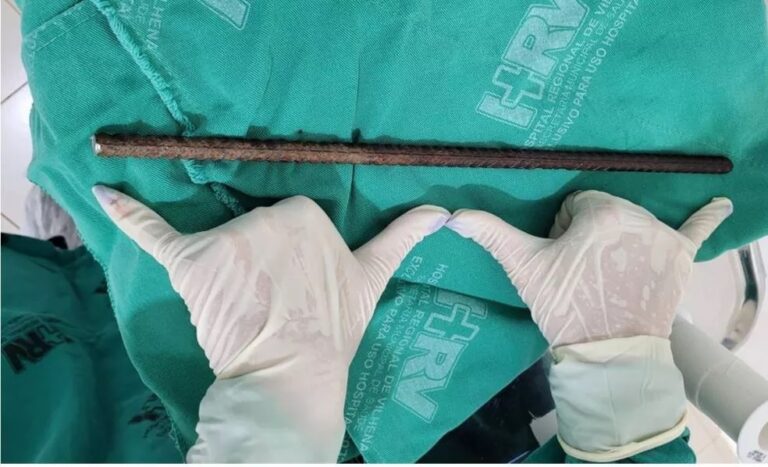 Vídeo: Idosa tem crânio perfurado ao cair em cima de barra de ferro com cerca de 40 cm