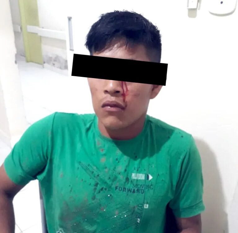 Índio Jaminawa sofre tentativa de homicídio e escapa ferido no rosto em Assis Brasil