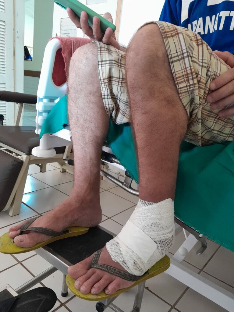 Morador picado por cobra venenosa está há um mês internado no Hospital de Sena