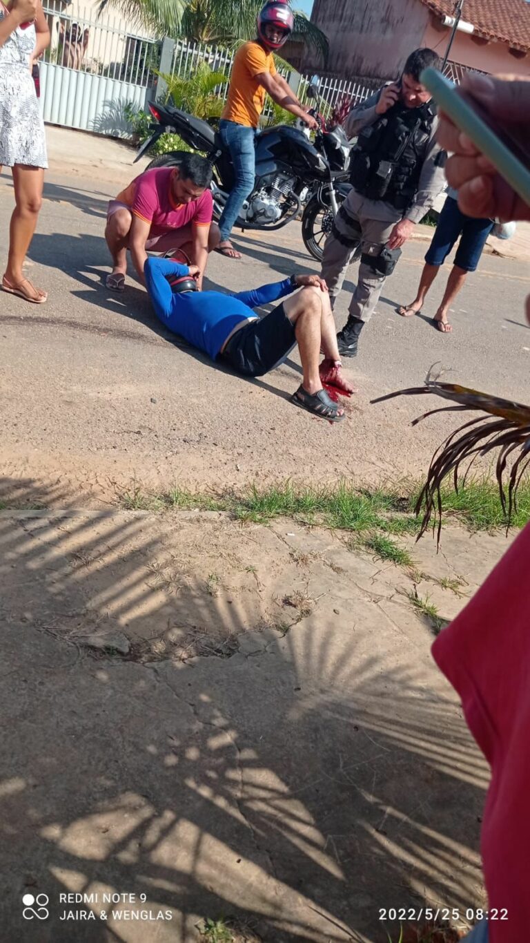 Morador de Sena Madureira quase tem o pé decepado em acidente de trânsito