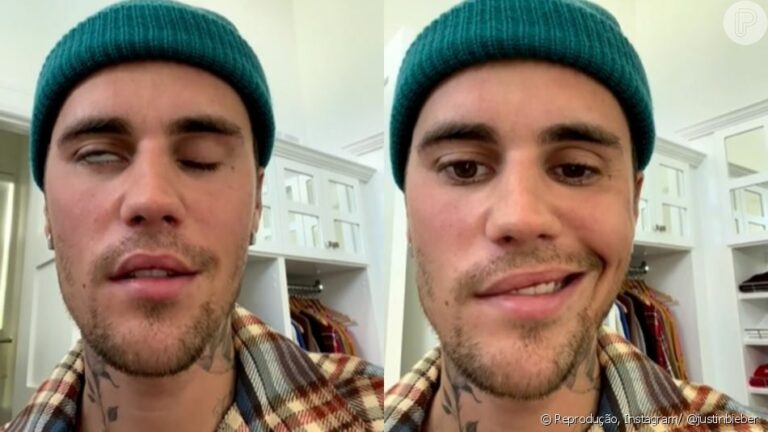 Vídeo: Justin Bieber mostra sequelas graves de doença após cancelar shows