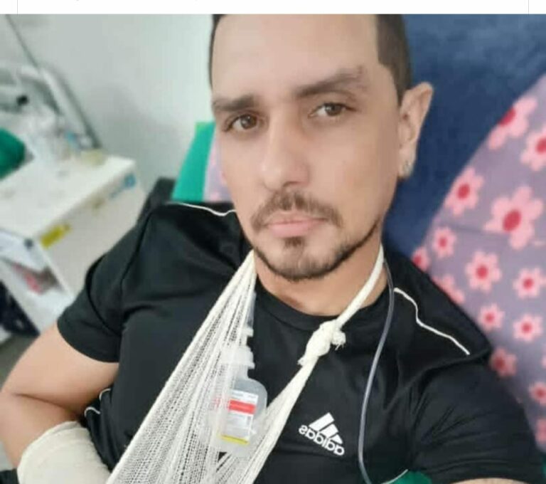 Guitarrista acreano quebra o pulso e amigos fazem campanha para ajudá-lo: “Não tem como trabalhar”