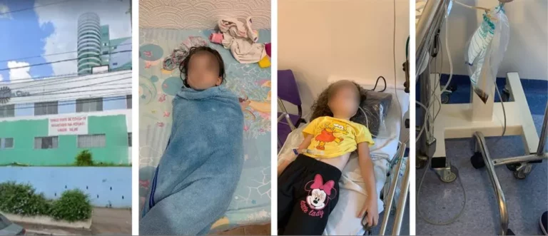 Criança de 5 anos internada por coma alcoólico ingeriu álcool em gel na escola