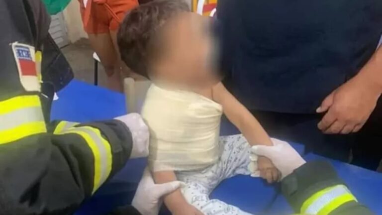 Bebê de 1 ano fica com espeto de churrasco preso ao ombro; FOTO
