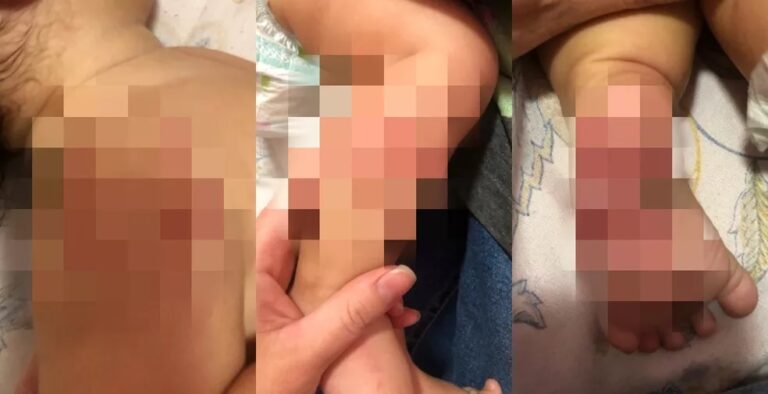 Mãe procura polícia após buscar bebê de nove meses com hematomas pelo corpo em creche
