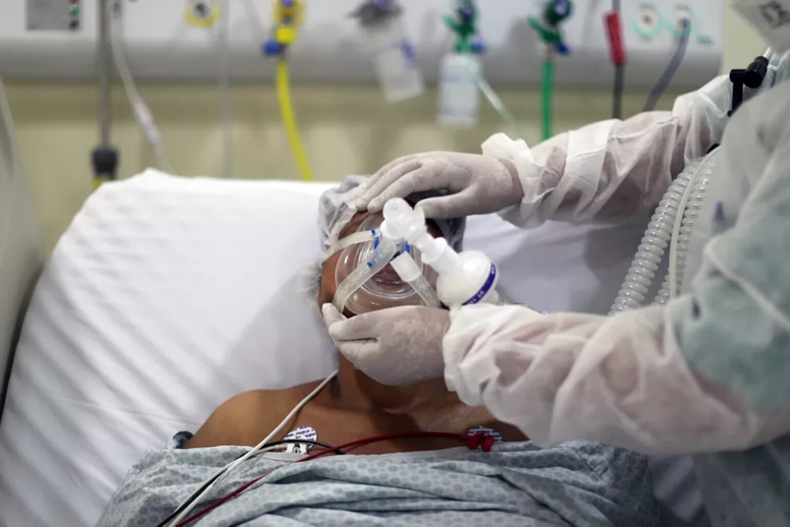 SRAG no Acre: cenário muda e doenças têm se espalhado mais entre jovens e idosos, diz Sesacre
