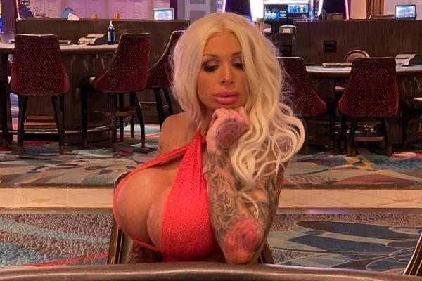 Atriz pornô mostra como está seio após prótese de silicone explodir