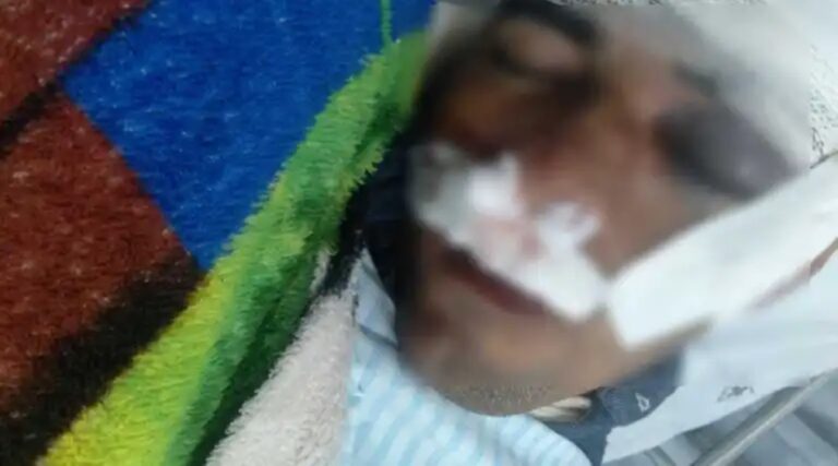 No Acre, homem que andava de bicicleta é atacado por cavalo e vai parar na UTI