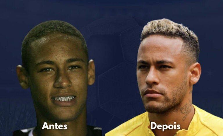 Cirurgião plástico acreano analisa antes e depois de jogadores famosos; imagens chocam