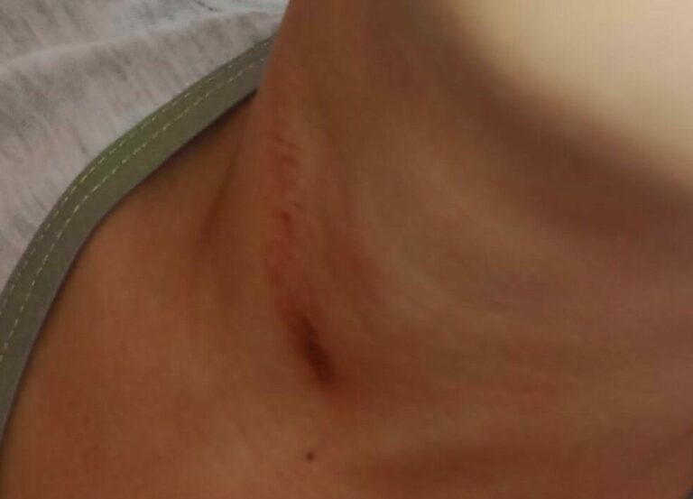 Criança de 7 anos é enforcada por PM após manifestar apoio a Lula