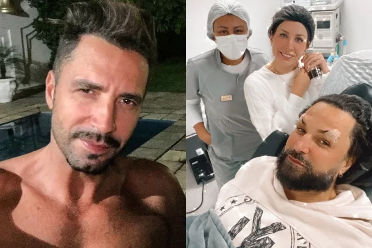 Latino, é você? Cantor investe alto em procedimento para rejuvenescer