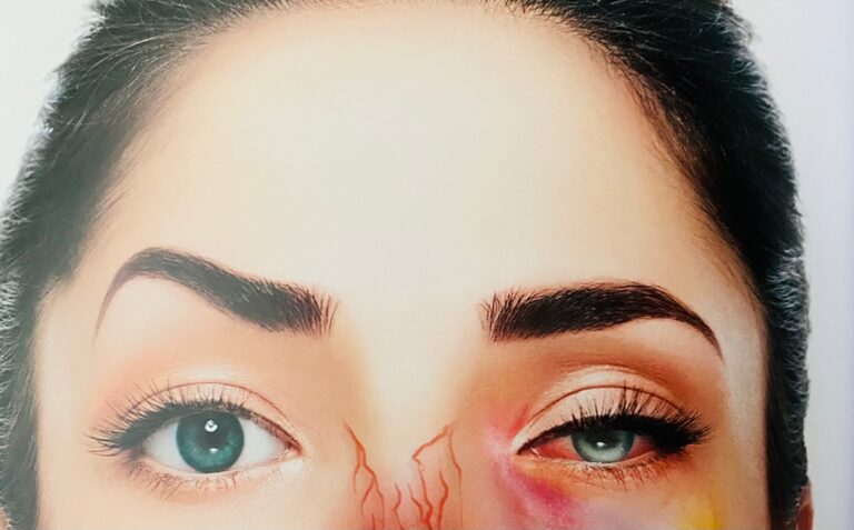 Dra. Kelma Roque explica riscos de intercorrências em procedimentos feitos por profissionais não habilitados