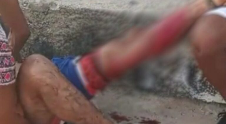 Surfista é mordido por tubarão na praia de Milagres, em Olinda