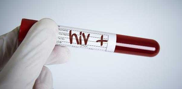 Pesquisadores comprovam que cérebro pode servir como ‘esconderijo’ para HIV