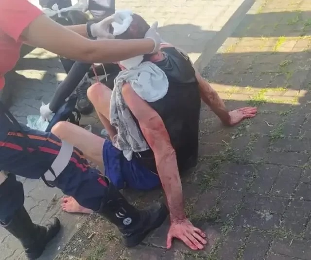 Vídeo: idoso atacado a facadas por homem nu teve olho perfurado