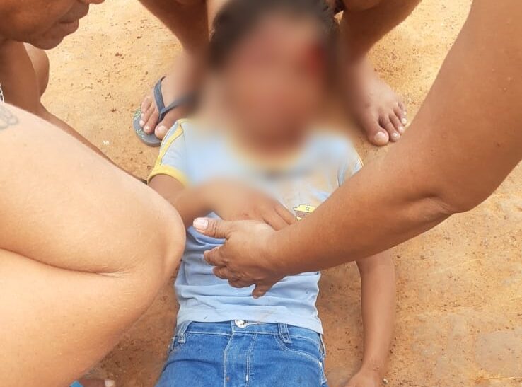 Ao sair da escola, criança cai em buraco e vai parar no PS; pais se revoltam com Prefeitura