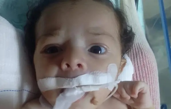Bebê de 2 meses morre após receber leite na veia ao invés de remédio