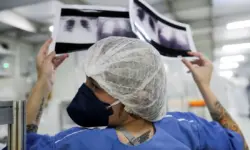 Acre é o 2º estado do Brasil com maior taxa de atendimento por sequelas da Covid
