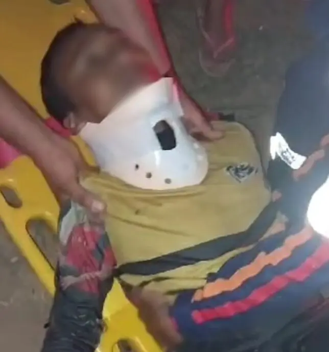 Homem fratura perna em acidente entre duas motos no Acre