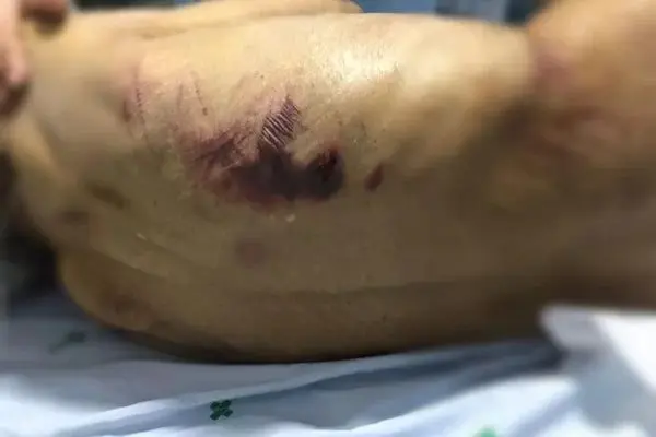 Polícia resgata 50 vítimas de cárcere e tortura em clínica clandestina