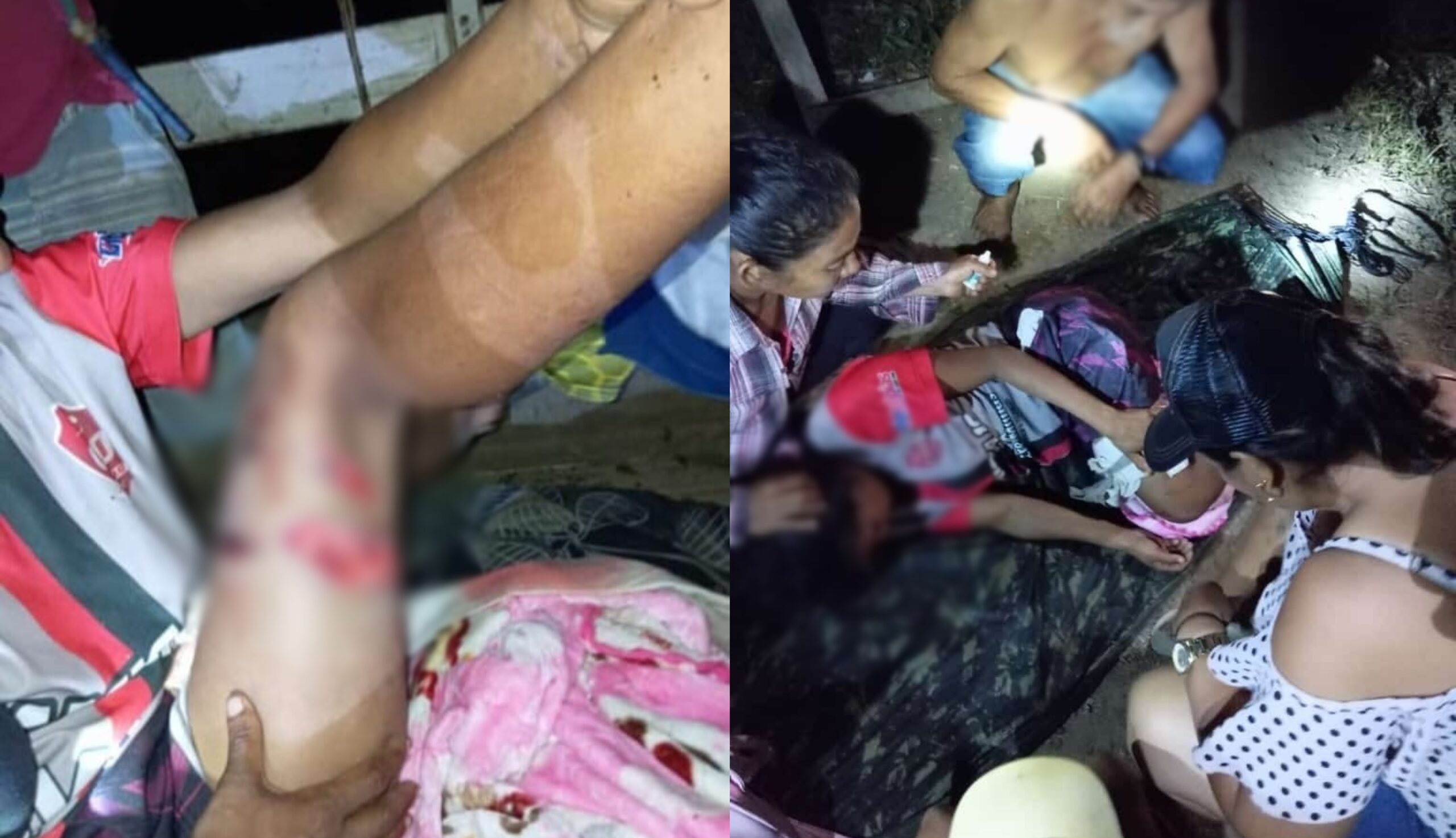 Mulher é atacada por jacaré em seringal do Rio Purus e dá entrada no PS
