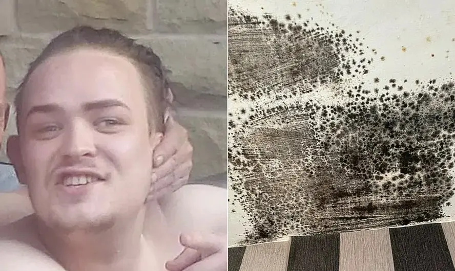 Jovem de 27 anos morre com fungo no pulmão depois de alugar casa infestada de mofo