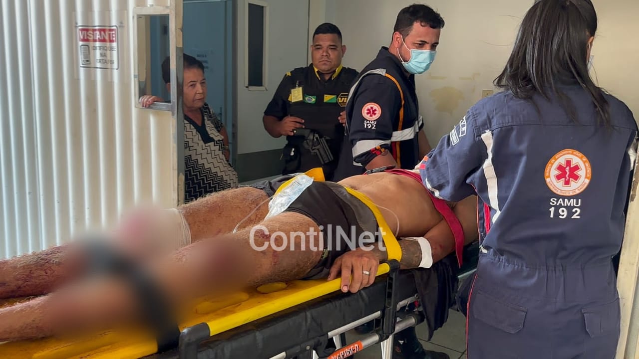 Colisão entre motos deixa uma pessoa com a perna amputada e outro ferido em Rio Branco