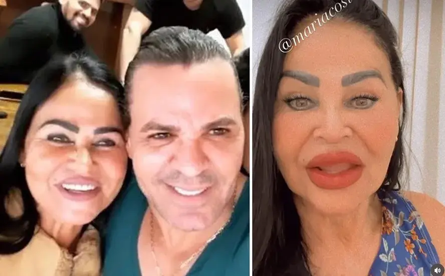 Mãe de Eduardo Costa nega harmonização após críticas por aparência: ‘Sou uma mulher rústica’