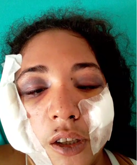 Mulher sobrevive depois de marido atirar em sua cabeça no interior do Acre; assista