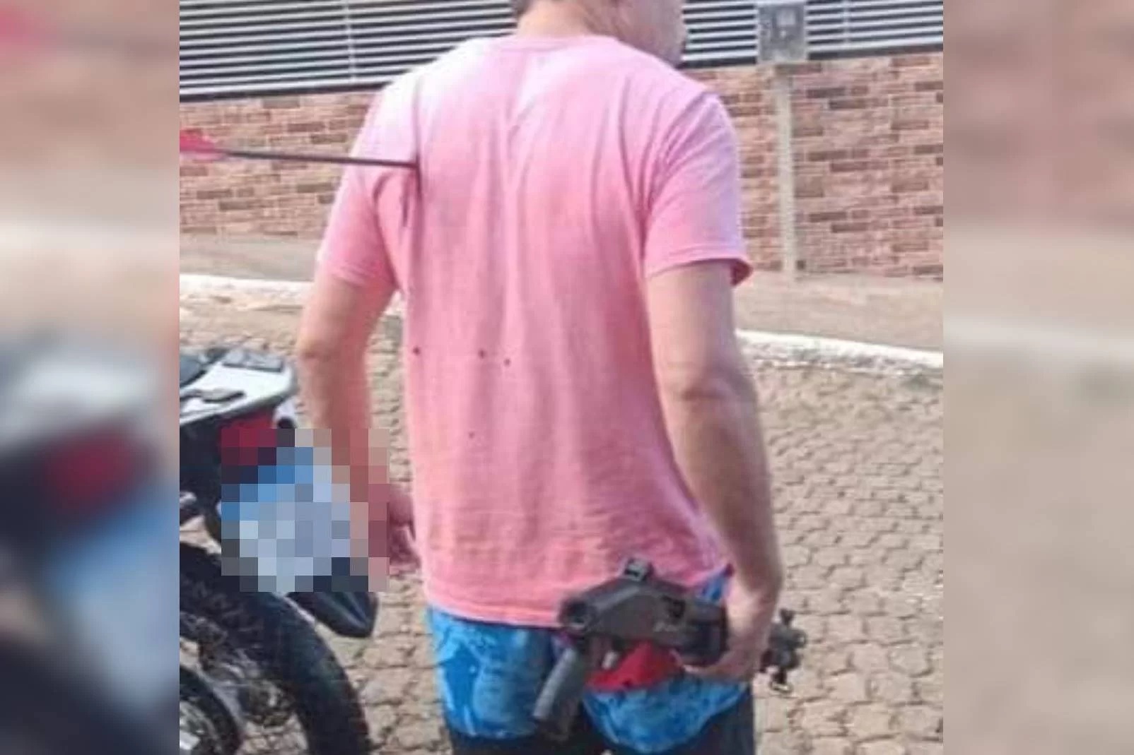 Homem fica com flecha cravada nas costas após briga entre vizinhos