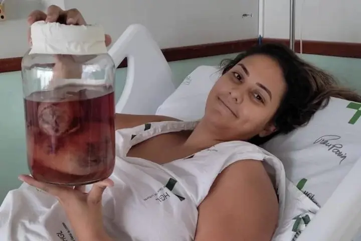 Mulher descobre câncer na gravidez, faz quimio e filha nasce saudável