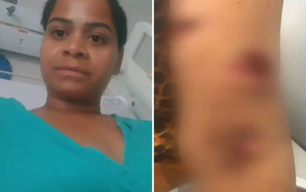 Vídeo: 3 pit-bulls soltos atacam mulher no meio da rua