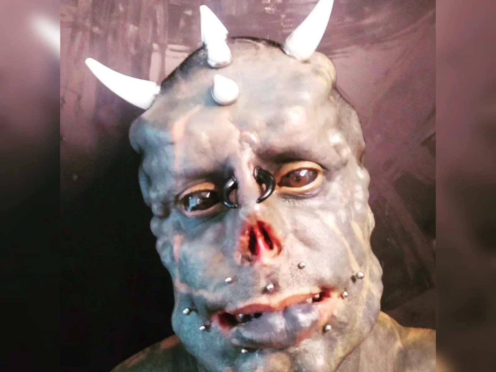 “Diabão” arranca mais dois dedos em projeto para ter “garras”; veja