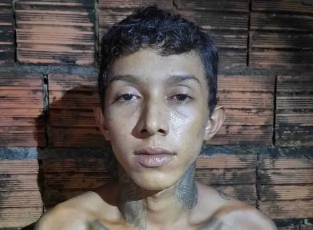 Monitorado por tornozeleira é atingido no olho durante tiroteio entre facções