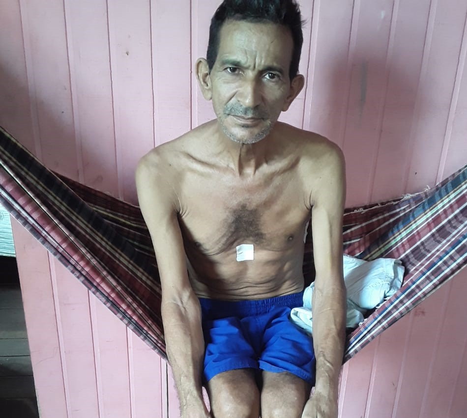 Família pede ajuda para morador de Sena Madureira diagnosticado com câncer de pulmão