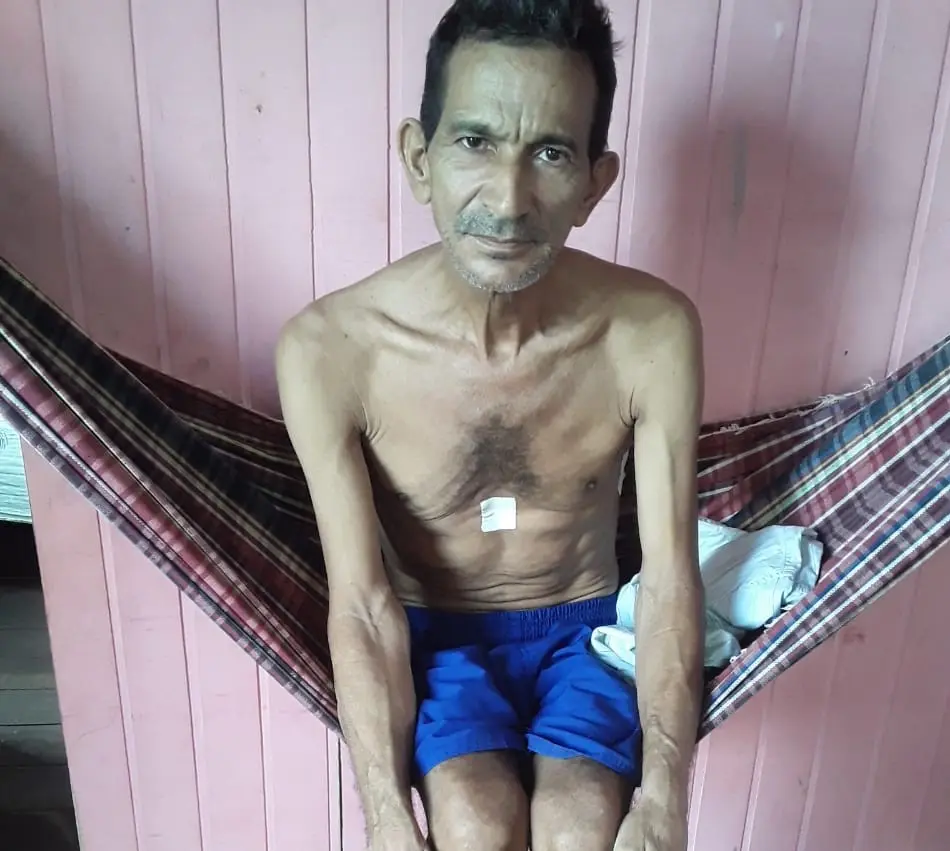 Família pede ajuda para morador de Sena Madureira diagnosticado com câncer de pulmão