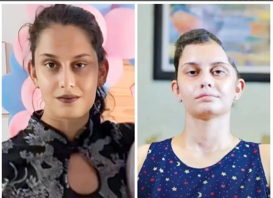 Jovem atingida por rampa em festival de rap faz reconstrução craniana