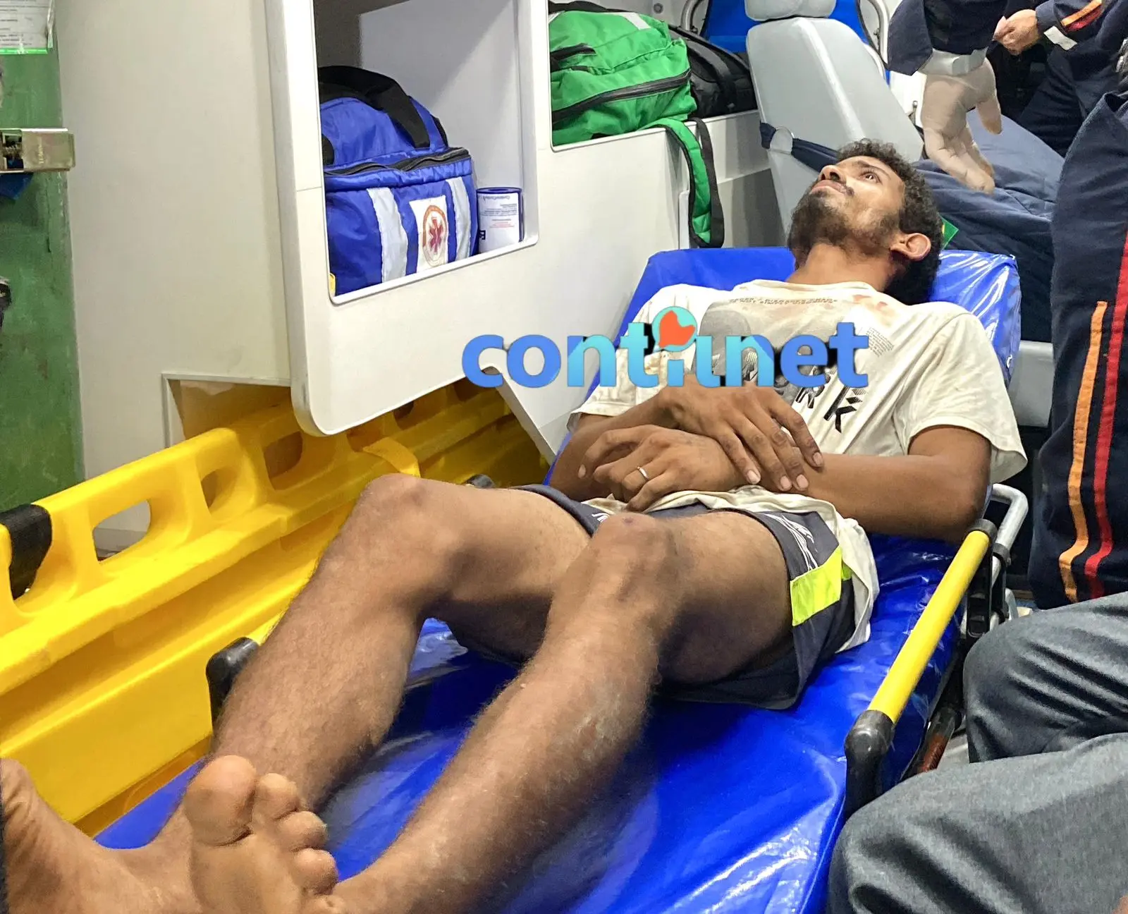 Homem é violentamente agredido e vai parar no PS de Rio Branco