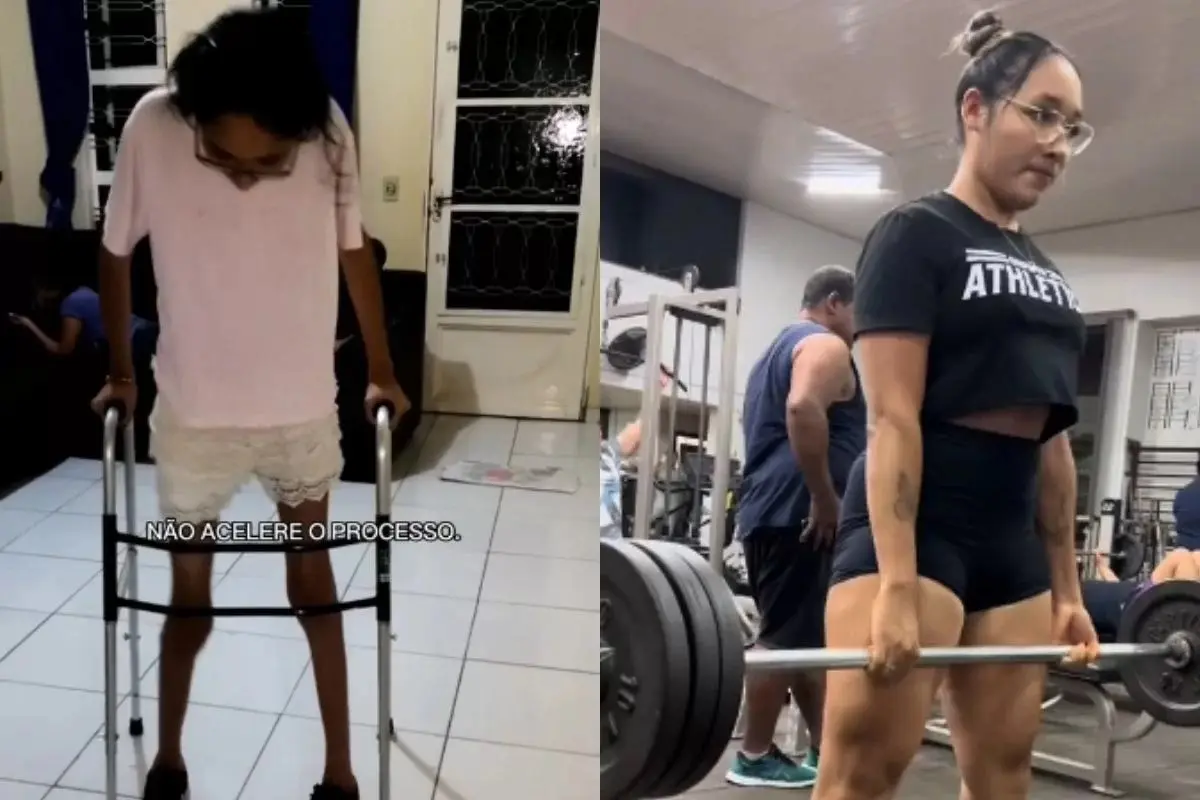 Jovem mostra evolução após ter dengue 2 vezes seguidas: “Pesava 29kg”