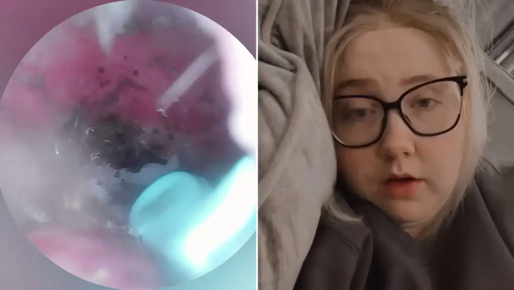 VÍDEO: após sentir algo estranho no ouvido, britânica descobre aranha e ninho dentro da orelha