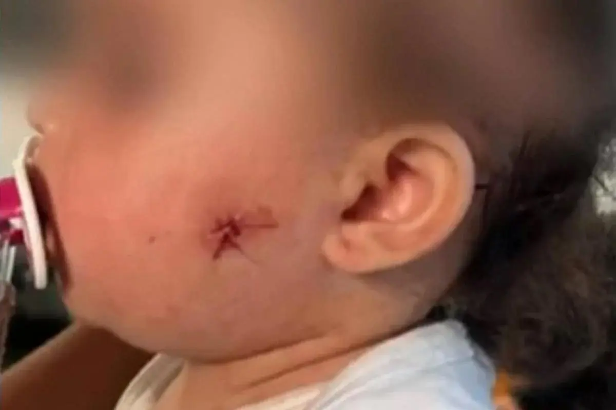 Vídeo: PM atira em bebê de um ano com airsoft; criança está internada