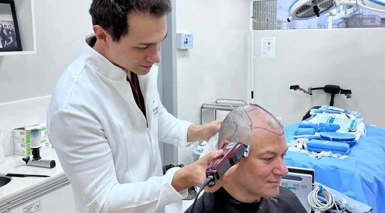Aos 48 anos, deputado federal faz transplante capilar no Acre para não ficar careca; FOTOS