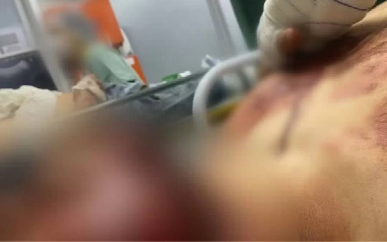Pai e filho de 7 anos são baleados dentro de casa