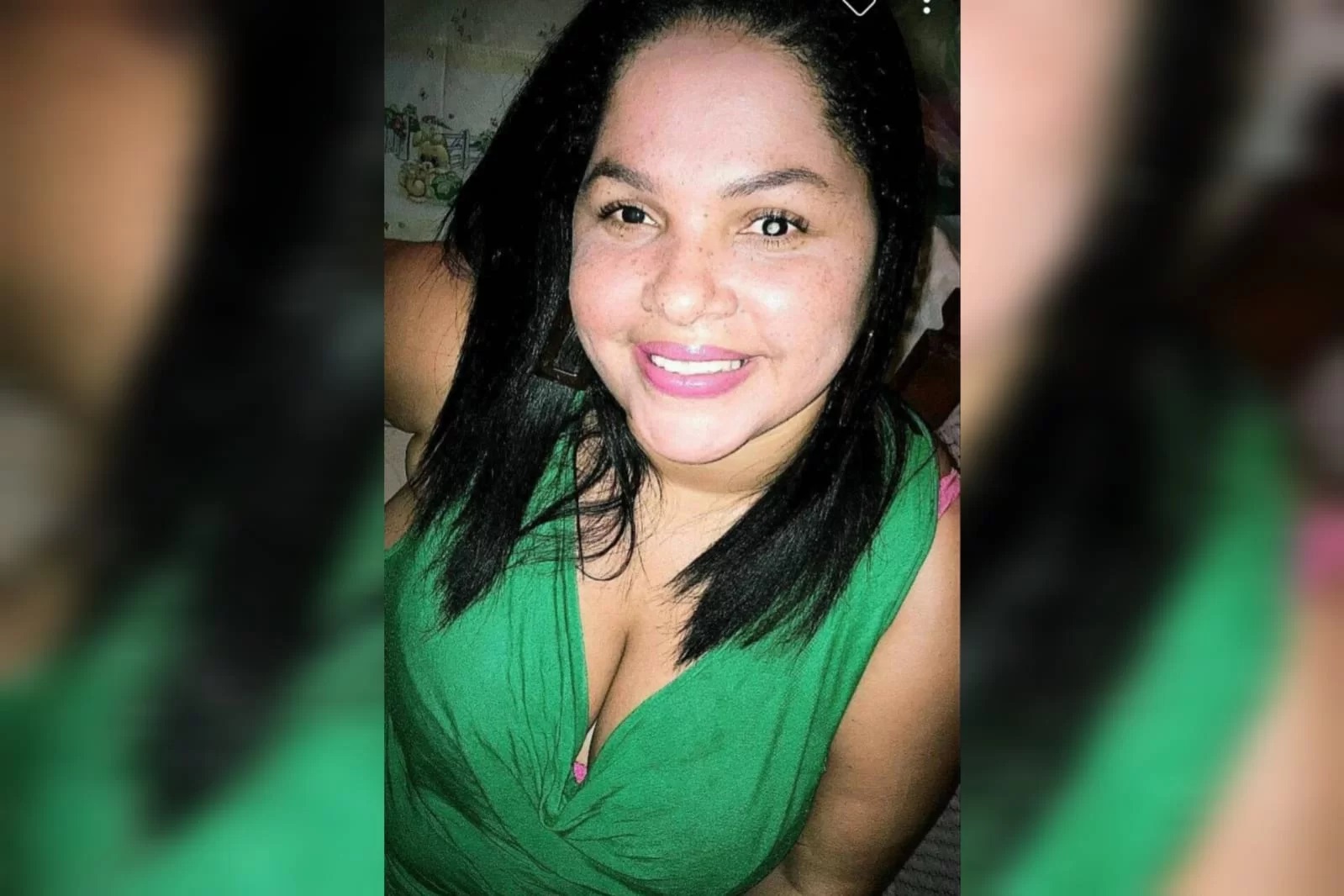 Mulher fica cega após ter apendicite e infecção generalizada; Entenda
