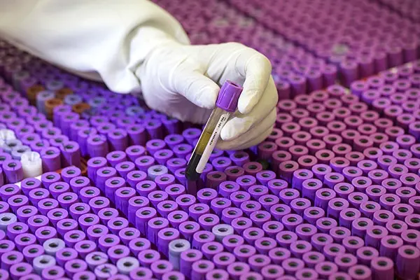 “60% dos testes negativos para dengue foram positivos para febre oropouche”, diz Sesacre