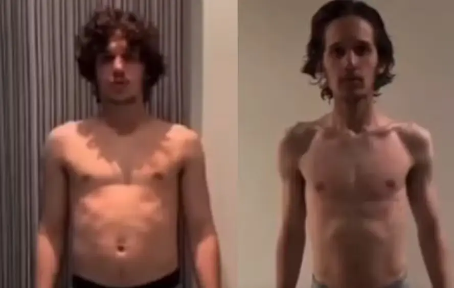 ‘Sociedade da Neve’: ator compartilha o antes e depois de perder 20 kg para o filme