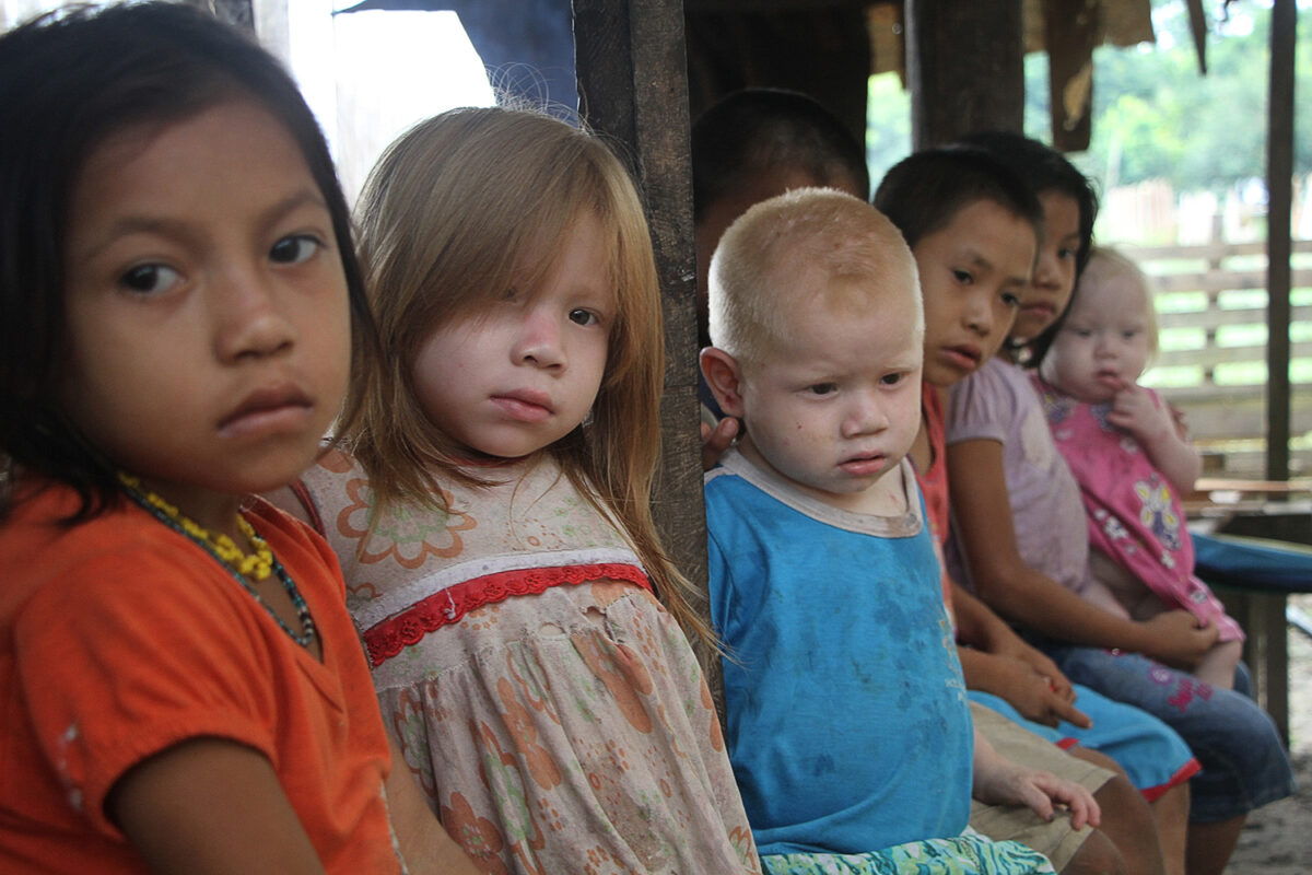 Povos Indígenas: conheça o drama vivido por irmãos albinos nascidos em aldeia no Acre